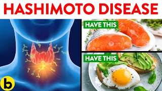 Foods To Eat And Avoid When You Have Hashimoto’s Disease