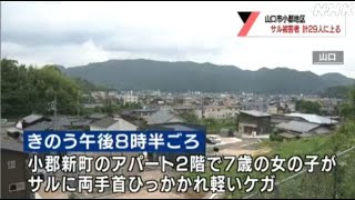 新たに男女３人サルに襲われケガ 被害者は計２９人に 山口県山口市小郡20220722(動物愛誤)(人身被害)(Animal Attacks)(アニマルホーダー)(サル痘)(Bウイルス病)(狂犬病)