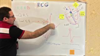 سلسلة فديوهات ال ECG المحاضرة الثالثة بعنوان Left Bundle Branch Block (LBBB