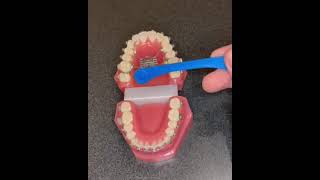How to Turn Your Child's Expander- Pediatric Dentistry & Family Orthodontics