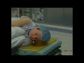 آموزش انواع پوزیشن های جراحی با دوبله فارسیtraining various surgical positions with persian dubbing