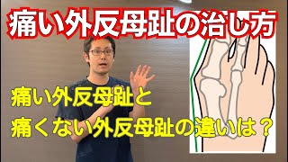 痛い外反母趾の原因とおすすめの治療法。「治療院の選び方」も紹介しています〜｜　京都市北区　もり鍼灸整骨院