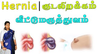 ஹெர்னியா | குடலிறக்கம் | தெளிவான விளக்கம் |  விரைவில் குணமாக | Hernia | Causes \u0026 Treatments | Tips