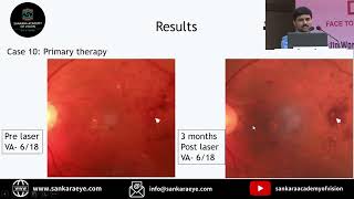 AIOC2022 - GP146-DR.PRADEEP SAGAR - PAPER [FP789] : TARGETED LASER PHOTOCOAGULATION OF RIM ANEUR..