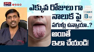 Fissured Tongue : Tongue Cracks Causes and Treatment  l Dr. Chava Anjaneyulu  @MedPlusONETV