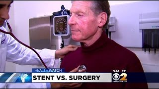 Dr. Max Gomez: Heart Stent Study