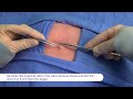 Suture Training Video