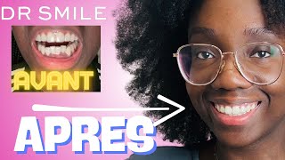 J'ai testé Dr Smile pendant 300 jours (Mon avis honnête)