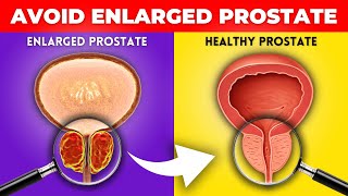 Most Harmful Foods For The Prostate (DON'T IGNORE) | Enlarged Prostate Treatment
