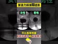 男性和女性排尿有啥区别你知道吗？ 医学科普 men and women urinate different from you do you know medical science