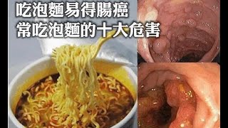 吃泡面易得腸癌 常吃泡面的十大危害(快點轉給身邊的朋友) | 新闻24小时