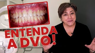 ENTENDA DE UMA VEZ POR TODAS O QUE É DVO - Mylene e Renato