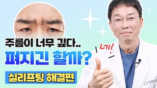 실리프팅으로 미간주름없애기? 필러보다 훨씬 좋은 이유(부작용, 효과, 유지기간)