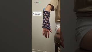 How is Cast21 applied? #cast21 #waterproof #fracture #orthopedics #shorts