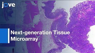 Next-generation Tissue Microarray(ngTMA): Biomarker Studies | Protocol Preview