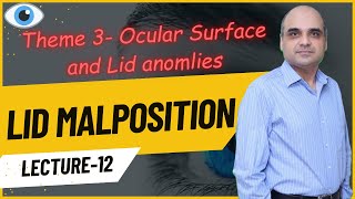 Lid Malpositions Lecture 12