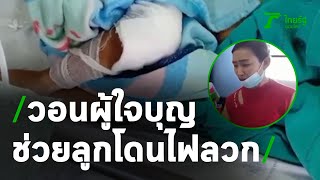 แม่ใจสลาย วอนช่วยลูก 8 ขวบโดนไฟลวก | 23-11-63 | ข่าวเช้าหัวเขียว