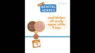 Genital Herpes pt 2