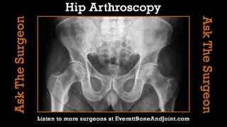 Hip Arthroscopy Surgery