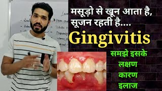 Gingivitis symptoms, causes, risk factors & treatment | Bleeding gums , swollen gums