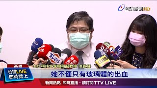 手機如自由落體猛砸 女黃斑部下出血水腫