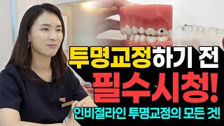 인비절라인을 이용한 교정을 하려고 했다면 이 영상을 꼭 시청?! 인비절라인 투명교정의 모든 것!