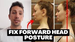 The Secret to Fixing Forward Head Posture (What They DON'T Tell You)