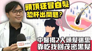 頭頂狂冒白髮恐肝出問題？中醫揭2大頭髮迷思　靠吃找回茂密黑髮｜中時新聞網