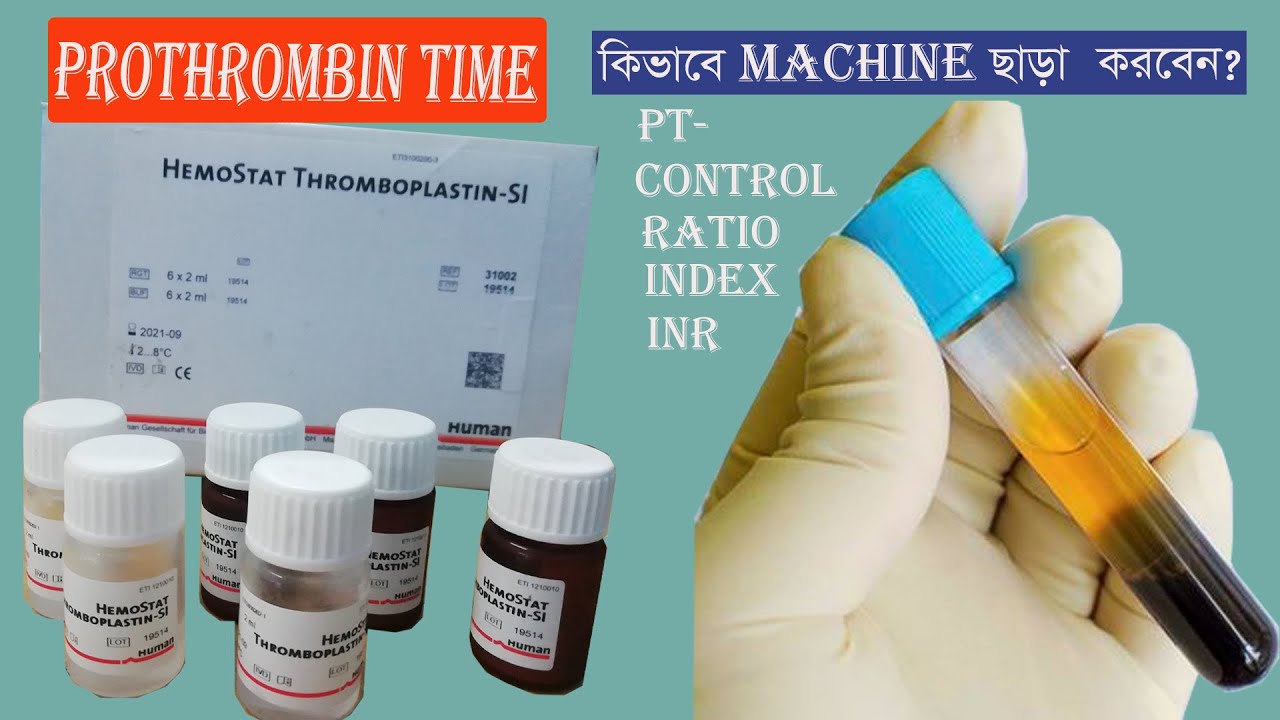 Prothrombin Time Test | PT, INDEX, INR - YouTube