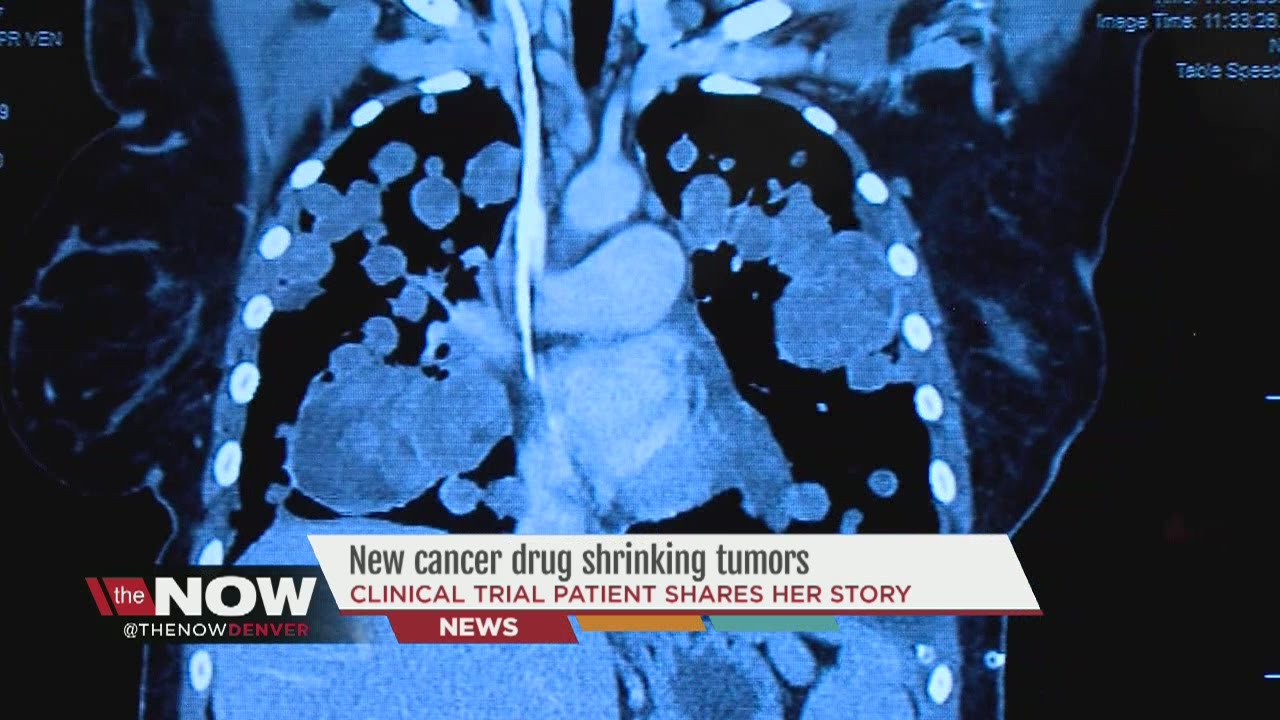 New Cancer Drug Shrinking Tumors - YouTube