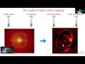 direct imaging of protoplanets