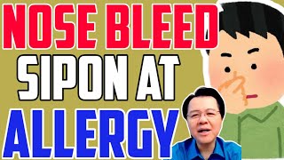 Nose Bleed, Allergy, May Kulangot - by Doc Willie Ong