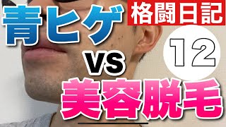 美容脱毛を12回やった結果。費用公開。IPL脱毛とSHR脱毛どっちが早い？にしてもIPLは痛い！