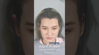 ปลูกให้มันจบ สยบทุกปัญหาเรื่องเส้นผม ผมบาง ศีรษะล้าน-เถิก บ่อเกิดความไม่มั่นใจ | 3M Hair Transplant