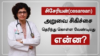 சிசேரியன்(cesarean) அறுவை சிகிச்சை தெரிந்து கொள்ள வேண்டியது என்ன? | Dr S M SreDevi | Tamil