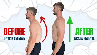 Fix Your Rounded Back Posture FULL ROUTINE