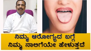 What does your tongue say about your health | Vijay Karnataka