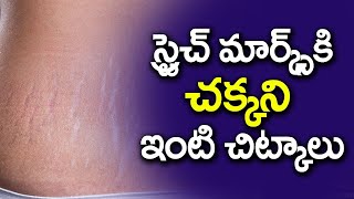 స్ట్రెచ్ మర్క్స్ కి ఇంటి చిట్కాలు | Home Tips for Stretch Marks | Eagle Health