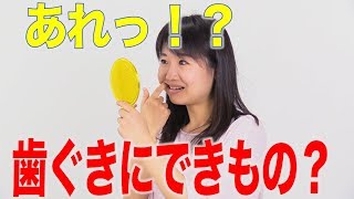 知ってますか？根尖病巣　口腔ケアチャンネル　1184（口腔ケアチャンネル2　＃856）