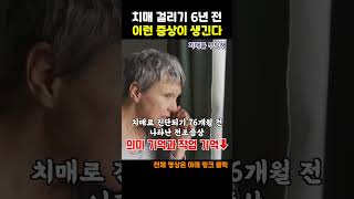 치매 걸리기 6년 전 이런 증상이 생긴다. 치매 전조증상