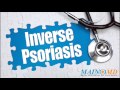 Inverse Psoriasis ¦ Treatment and Symptoms