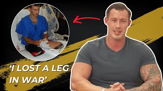 Fox News' Joey Jones Opens Up About Losing His Legs
