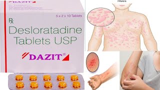 Dazit Tablet review in hindi/Desloratadine tablet use/Dose/side effects/best antiallergic medicine