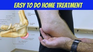 Elbow Bursitis Treatment at Home - How to Treat Olecranon Bursitis