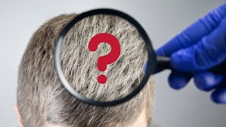 What causes gray hair?