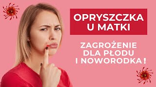 Opryszczka u matki - zagrożenie dla płodu i noworodka!