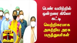 பெண் வயிற்றில் ஒன்றரை கிலோ கட்டி - வெற்றிகரமாக அகற்றிய அரசு மருத்துவர்கள் | Virudhunagar |