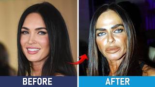 Celebrity Plastic Surgery Disasters ⁉️😱