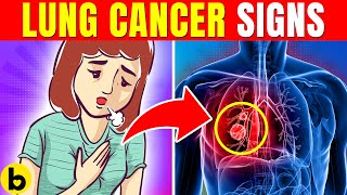 Early Warning Signs Of Lungs Cancer You Should Not Ignore