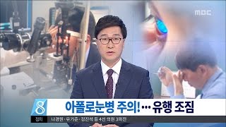 [대전MBC뉴스]유행성 눈병 주의